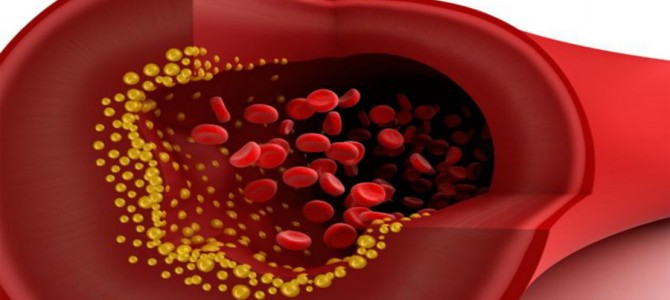 Científicos españoles descubren una molécula que provoca la arteriosclerosis